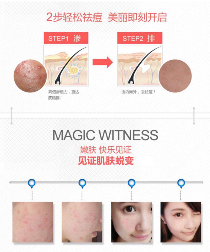 Lion Acne Cream 24g